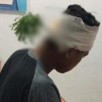 Ngeri! Remaja di Pohuwato Tertembak Panah Wayer di Kepala