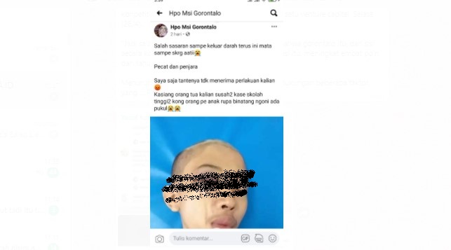 Curhat di FB, Seorang Anak Mengaku Dianiaya Oknum Berseragam Aparat