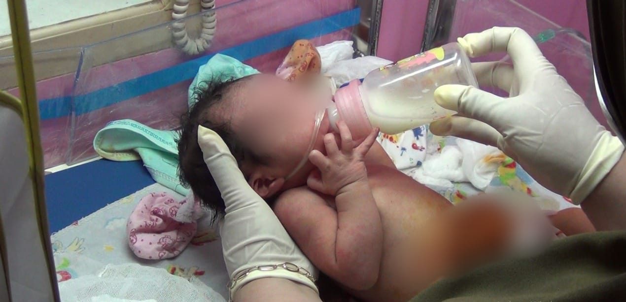 Alami Infeksi, Bayi yang Dibuang Dirujuk ke RS Dunda Limboto