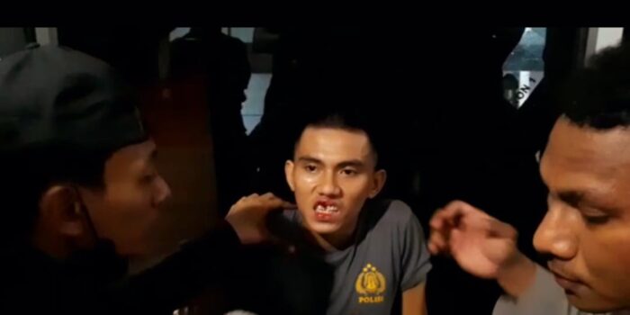 Polisi Alami Patah Gigi Usai Ricuh dengan Massa Aksi Tolak UU Cipta Kerja