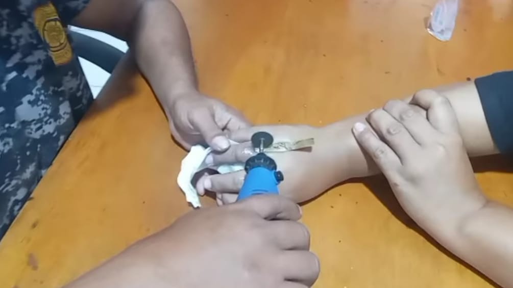 Lepas Cincin