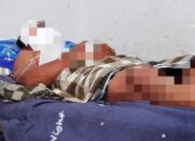 Alami 36 Luka Jahitan, Korban Longsor Tambang Dirujuk ke RS Aloei Saboe