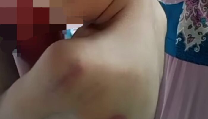 Polisi Ungkap Motif Ibu Tiri Aniaya Anak di Gorontalo