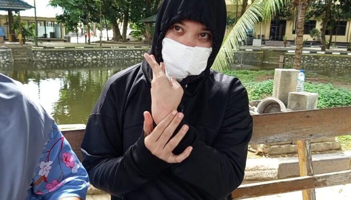 Oknum Polisi di Gorontalo Diduga Aniaya Pacar hingga Luka Lebam