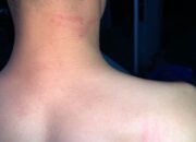 Dituding Ikut Demo, Mahasiswa UNG Mengaku Dipukul Oknum Polisi 