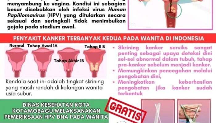Cegah Kanker Serviks, Dinkes Kotamobagu Gelar Pemeriksaan HPV-DNA Gratis