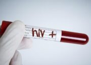 Kasus HIV-AIDS Meningkat di Gorontalo, 83 Kasus Baru Ditemukan