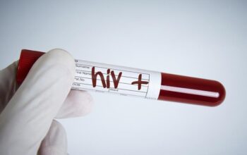 Kasus HIV-AIDS Meningkat di Gorontalo, 83 Kasus Baru Ditemukan